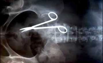 x-ray scissors