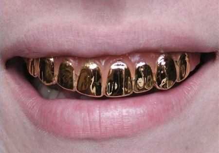 Golden Teeth